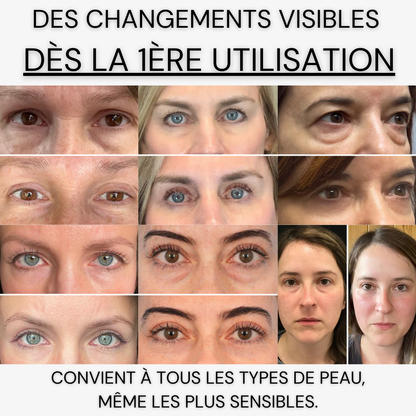 Patchs Reveli - PDRN & Collagène