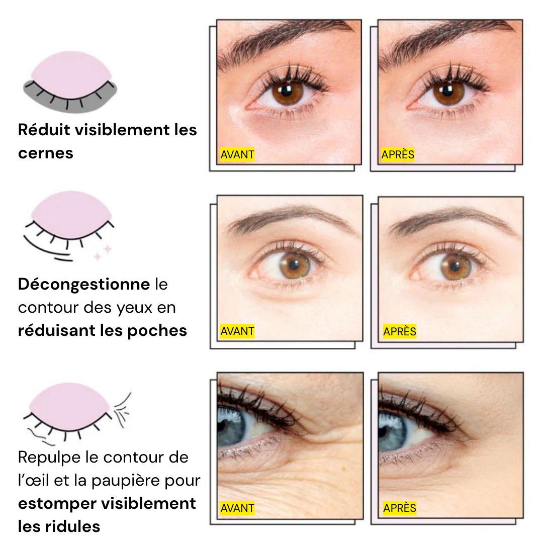 Patchs Reveli - PDRN & Collagène